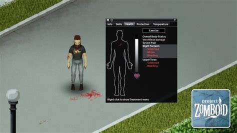 Project Zomboid: A Bite-Sized Taste of Post-Apocalyptic Survival Nightmare!